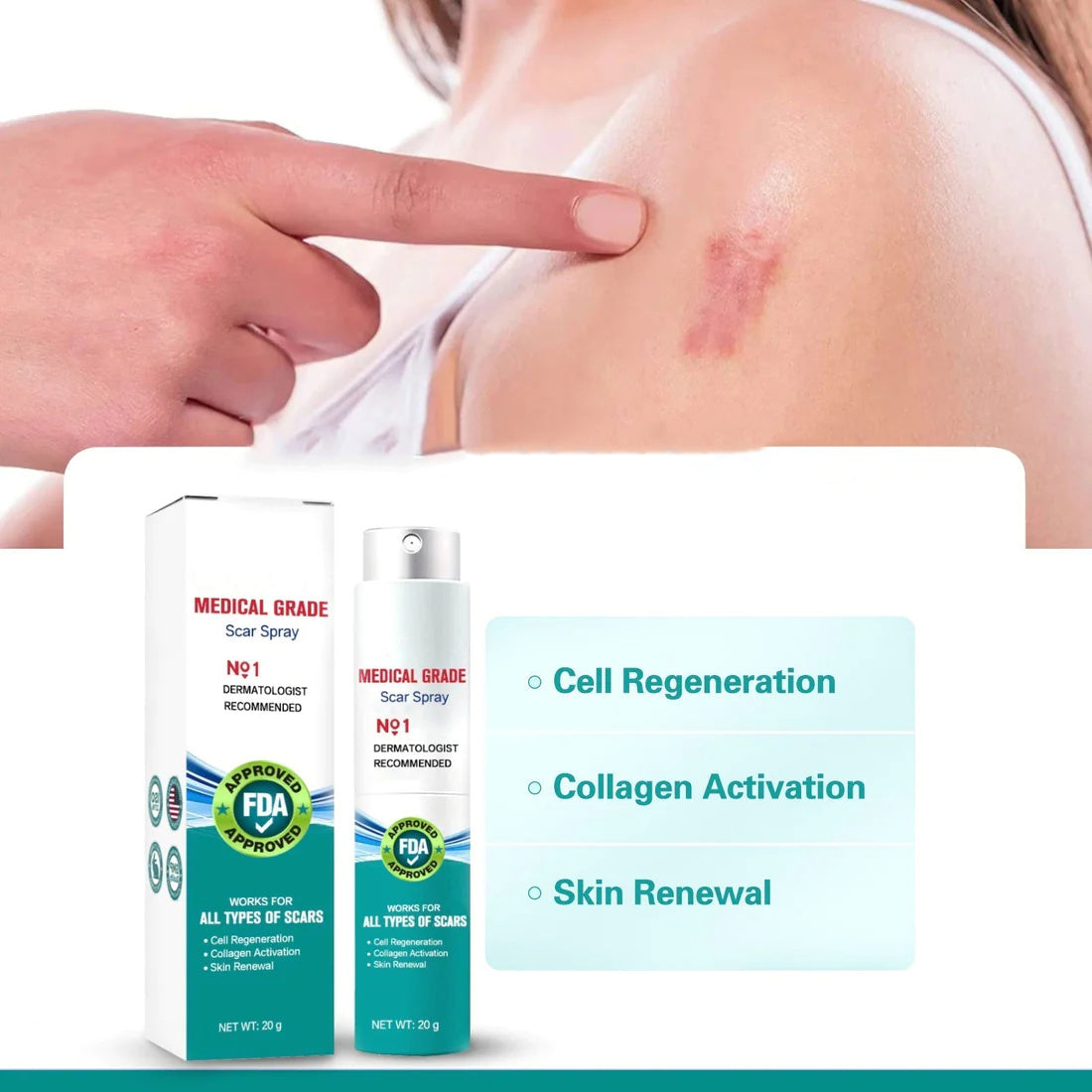 🔥Hot Sale🔥Scar Remove – Medical Grade Scar Spray(For example Acne Scars, Surgical Scars and Stretch Marks ⚡️⚡️⚡️)