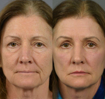 🔥Hot Sale 50% OFF🔥Luxevéria Foundation | Visibly smooths wrinkles in just 2 minutes – radiant skin that lasts all day!