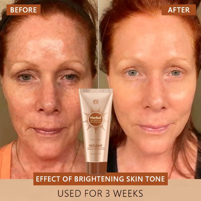 🔥Limited Time Discount🔥Whitening and Spot-Removing Face Mask Suitable for face and body – 👩‍⚕️ Natural ingredients permanently remove age spots, freckles, sun spots, and liver spots.