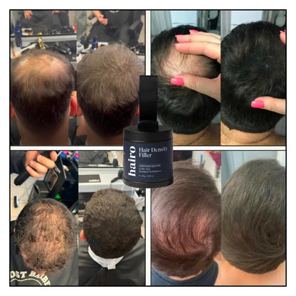 🔥Limited Time Discount 💥Hair Density Filler