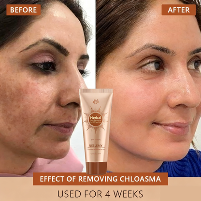 🔥Limited Time Discount🔥Whitening and Spot-Removing Face Mask Suitable for face and body – 👩‍⚕️ Natural ingredients permanently remove age spots, freckles, sun spots, and liver spots.