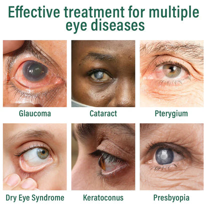 Nexisify® Nano Eye Drops Serum ✅FDA Approved(Suitable for presbyopia, dry eye syndrome, glaucoma, and cataracts) ☘️☘️