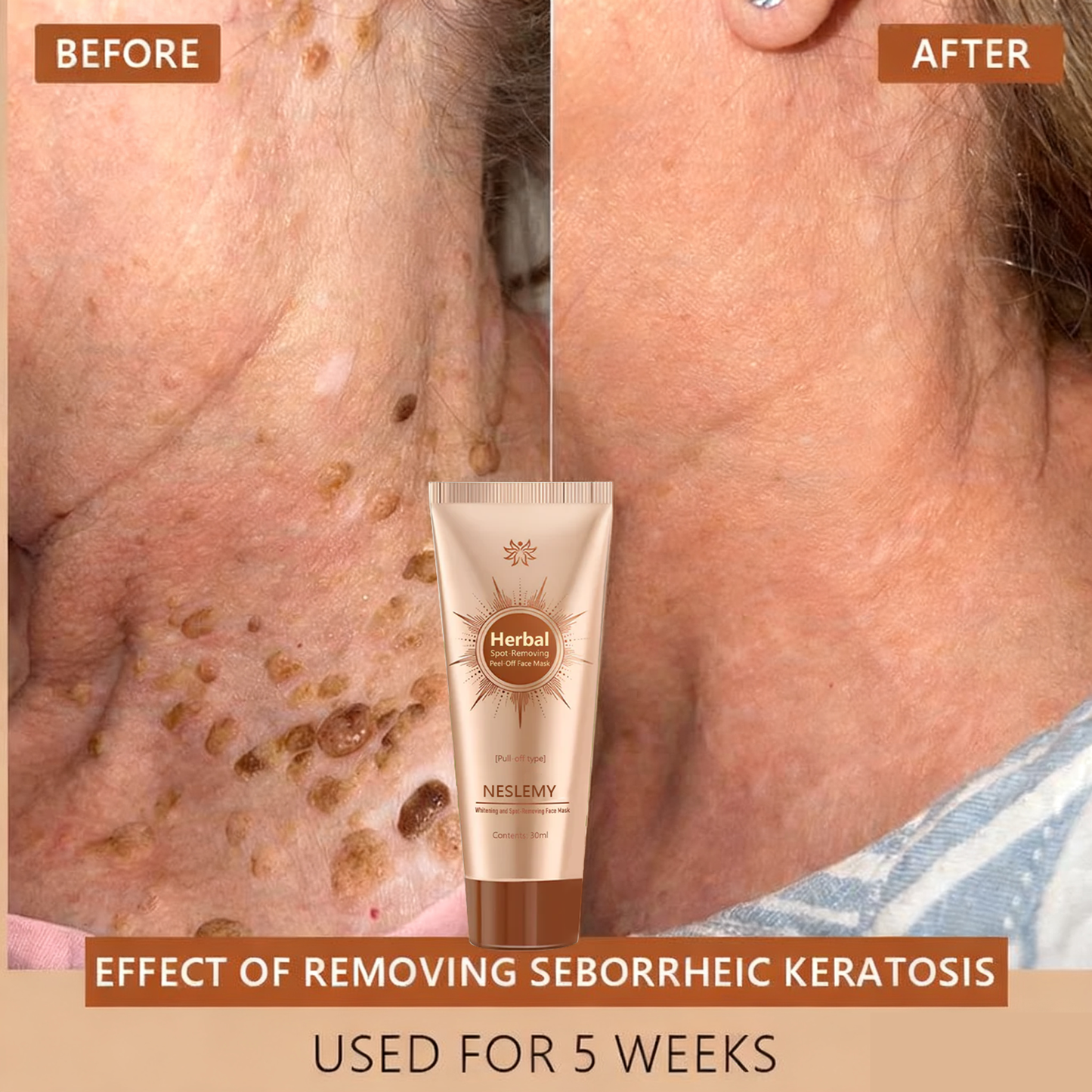 🔥Limited Time Discount🔥Whitening and Spot-Removing Face Mask Suitable for face and body – 👩‍⚕️ Natural ingredients permanently remove age spots, freckles, sun spots, and liver spots.