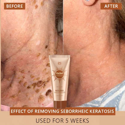 🔥Limited Time Discount🔥Whitening and Spot-Removing Face Mask Suitable for face and body – 👩‍⚕️ Natural ingredients permanently remove age spots, freckles, sun spots, and liver spots.