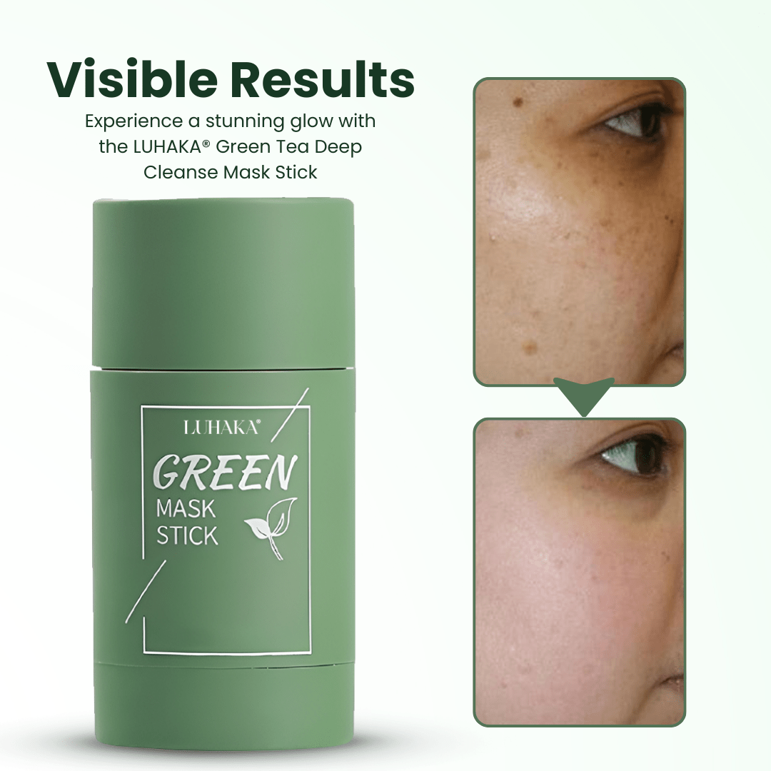 🔥Hot Sale 50% OFF🔥Natravor®  Green Tea Deep Cleanse Mask Stick ACE 1
