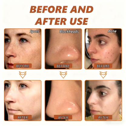 🔥Limited Time Discount🔥Whitening and Spot-Removing Face Mask Suitable for face and body – 👩‍⚕️ Natural ingredients permanently remove age spots, freckles, sun spots, and liver spots.