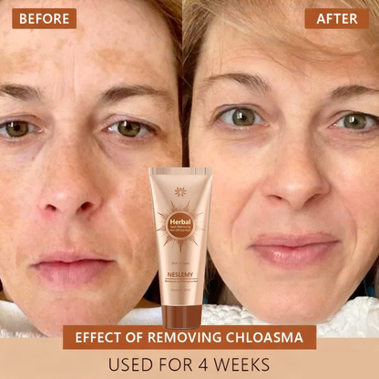 🔥Limited Time Discount🔥Whitening and Spot-Removing Face Mask Suitable for face and body – 👩‍⚕️ Natural ingredients permanently remove age spots, freckles, sun spots, and liver spots.