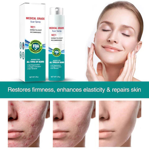 🔥Hot Sale🔥Scar Remove – Medical Grade Scar Spray(For example Acne Scars, Surgical Scars and Stretch Marks ⚡️⚡️⚡️)