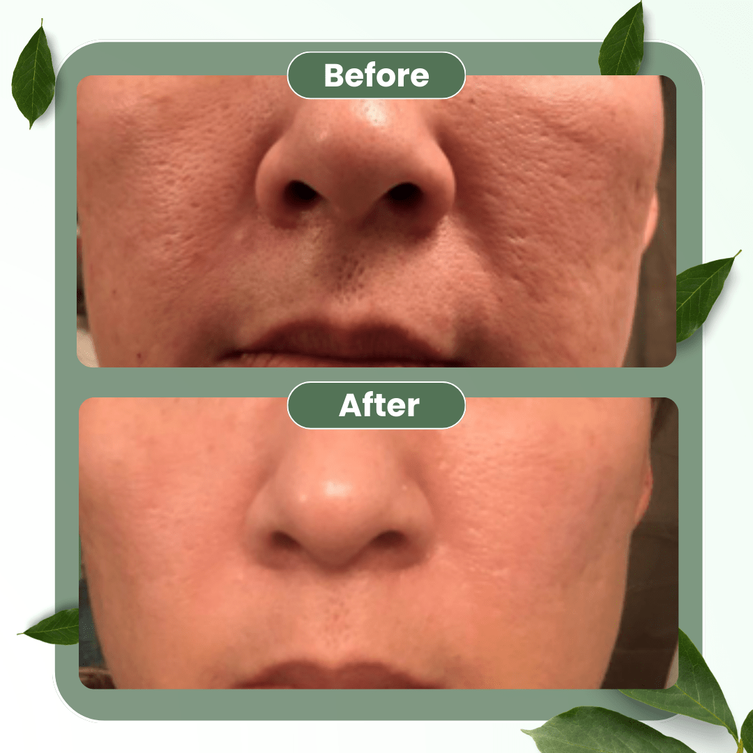 🔥Hot Sale 50% OFF🔥Natravor®  Green Tea Deep Cleanse Mask Stick ACE 1