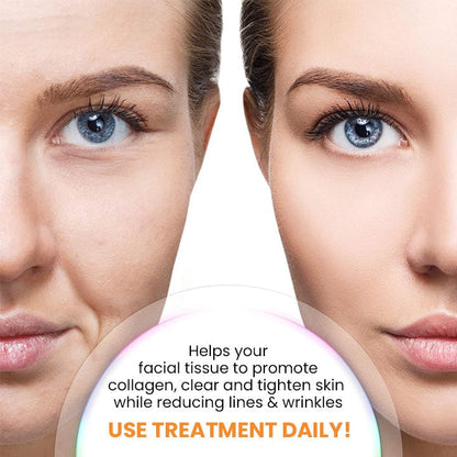 🔥Last Day Promotion 49% OFF -- LOVILDSTM Korean Dermalayr Technology Soluble Collagen Film