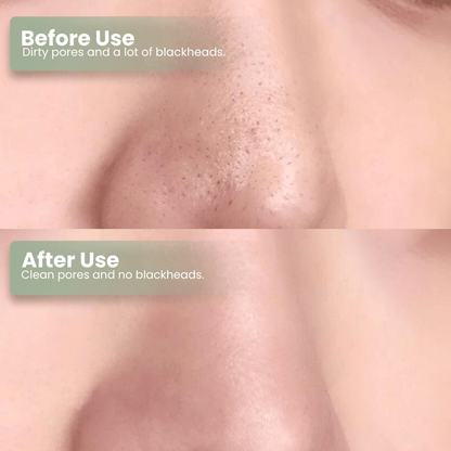 🔥Hot Sale 50% OFF🔥Natravor®  Green Tea Deep Cleanse Mask Stick ACE 1