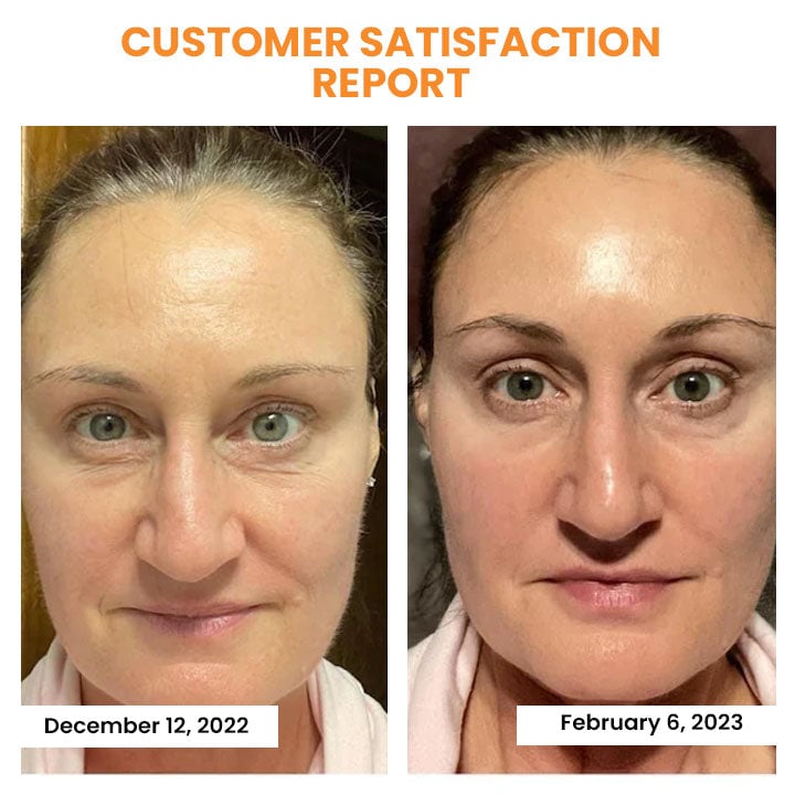 🔥Last Day Promotion 49% OFF -- LOVILDSTM Korean Dermalayr Technology Soluble Collagen Film