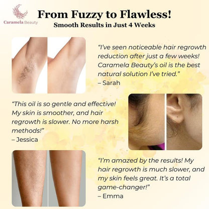 🔥Limited Time Discount 💥Caramela Beauty Cyperus Rotundus Oil for Natural Permanent Hair Reduction