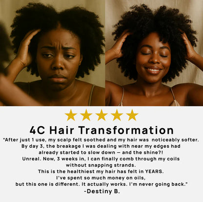 🔥Limited Time Discount🔥Batana Oil - Hair Regeneration Essential Oil, Rapidly Improves Hair Quality