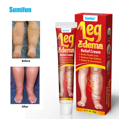 🔥Limited Time Discount 🔥Swelling Cream - Relieves Swelling